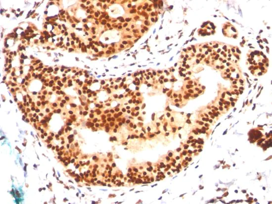 Immunohistochemistry (Formalin/PFA-fixed paraffin-embedded sections) - Anti-Sumo 2 + Sumo 3 antibody [SM23/496] (AB190757)
