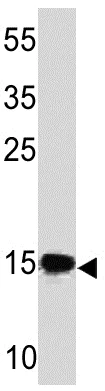 Western blot - Anti-Sumo 2 + Sumo 3 antibody [SM23/496] (AB190757)