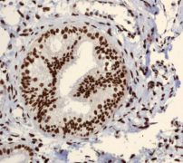Immunohistochemistry (Formalin/PFA-fixed paraffin-embedded sections) - Anti-Sumo 2 + Sumo 3 + Sumo 4 antibody [EPR300(2)] (AB109196)