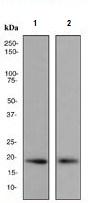 Anti-Sumo 2 + Sumo 3 + Sumo 4 antibody [EPR300(2)]