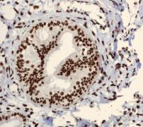 Immunohistochemistry (Formalin/PFA-fixed paraffin-embedded sections) - Anti-Sumo 2 + Sumo 3 + Sumo 4 antibody [EPR300(2)] - BSA and Azide free (AB247789)