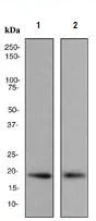 Western blot - Anti-Sumo 2 + Sumo 3 + Sumo 4 antibody [EPR300(2)] - BSA and Azide free (AB247789)