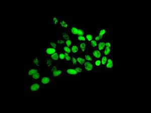 Immunocytochemistry/ Immunofluorescence - Anti-Sumo 2 + Sumo 3 + Sumo 4 antibody [EPR7163] (AB126606)