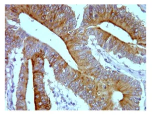 Immunohistochemistry (Formalin/PFA-fixed paraffin-embedded sections) - Anti-Sumo 3 antibody [1H9L17] (AB203570)