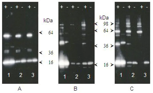 Western blot - SUMOylation Assay Kit (AB139470)