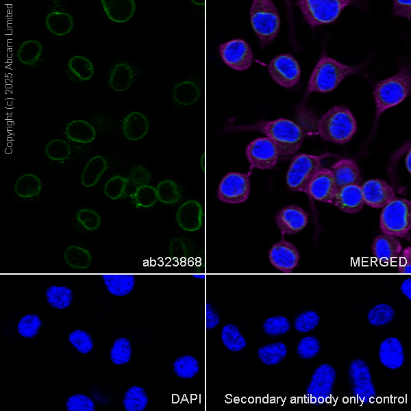 Immunocytochemistry/ Immunofluorescence - Anti-SUN1 antibody [EPR29563-76] (AB323868), expandable thumbnail
