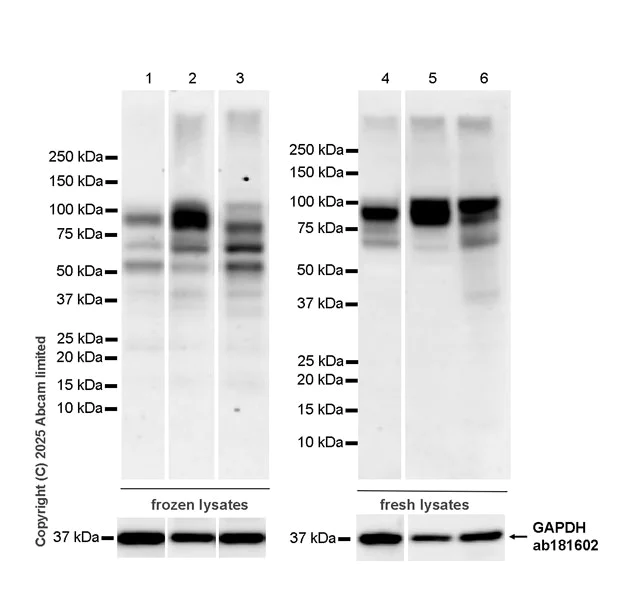 Western blot - Anti-SUN1 antibody [EPR29563-76] (AB323868)