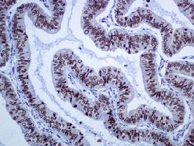 Immunohistochemistry (Formalin/PFA-fixed paraffin-embedded sections) - Anti-SUN1 antibody [EPR6554] (AB124770), expandable thumbnail