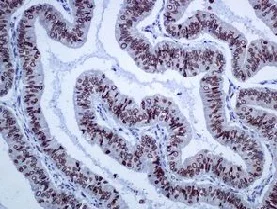 Immunohistochemistry (Formalin/PFA-fixed paraffin-embedded sections) - Anti-SUN1 antibody [EPR6554] (AB124770)
