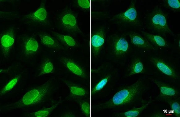 Immunocytochemistry/ Immunofluorescence - Anti-SUN1 antibody [HL1946] - BSA and Azide free (AB327554)