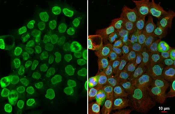 Immunocytochemistry/ Immunofluorescence - Anti-SUN1 antibody [HL1946] - BSA and Azide free (AB327554)