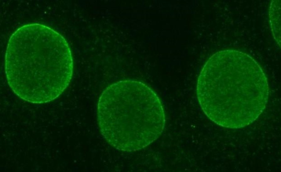Immunocytochemistry - Anti-SUN2 antibody (AB87036), expandable thumbnail