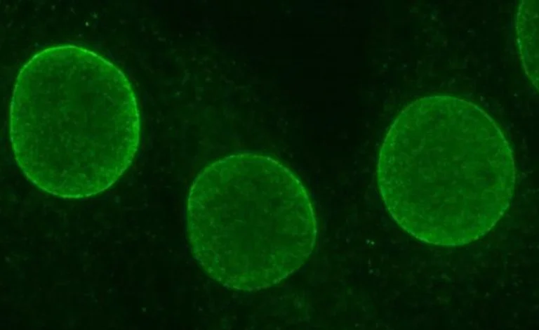 Immunocytochemistry - Anti-SUN2 antibody (AB87036)