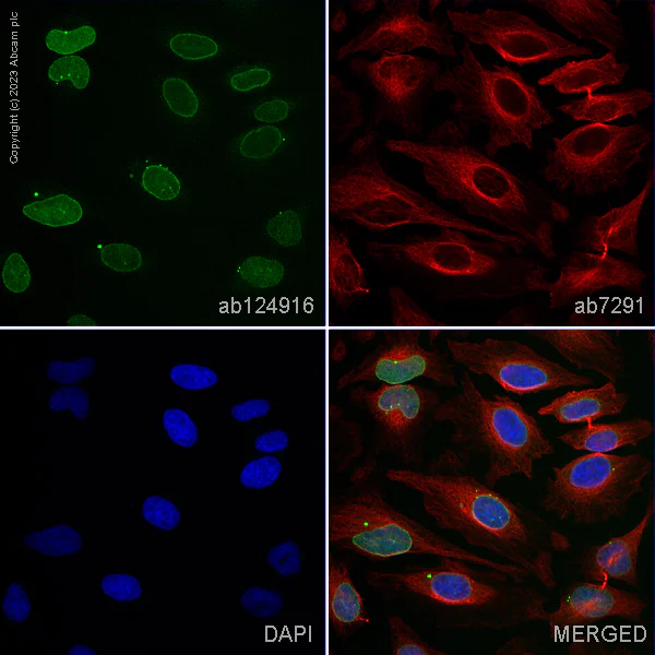 Immunocytochemistry/ Immunofluorescence - Anti-SUN2 antibody [EPR6557] (AB124916)