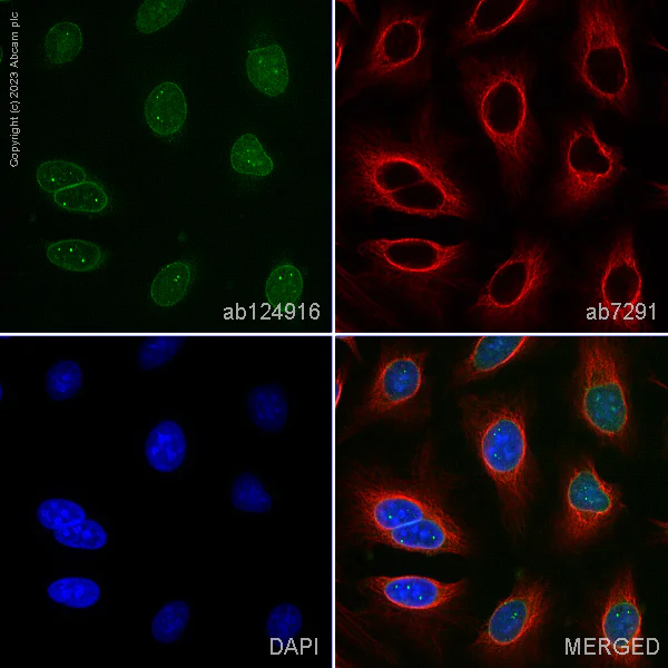 Immunocytochemistry/ Immunofluorescence - Anti-SUN2 antibody [EPR6557] (AB124916)