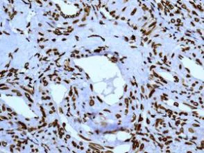 Immunohistochemistry (Formalin/PFA-fixed paraffin-embedded sections) - Anti-SUN2 antibody [EPR6557] (AB124916)