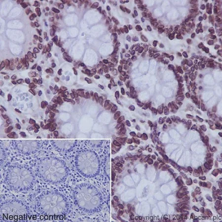 Immunohistochemistry (Formalin/PFA-fixed paraffin-embedded sections) - Anti-SUN2 antibody [EPR6557] (AB124916)