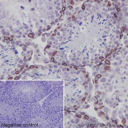 Immunohistochemistry (Formalin/PFA-fixed paraffin-embedded sections) - Anti-SUN2 antibody [EPR6557] (AB124916)