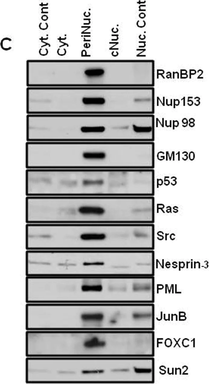 Western blot - Anti-SUN2 antibody [EPR6557] (AB124916)