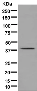 Western blot - Anti-SUN3 antibody [EPR12910] - BSA and Azide free (AB250320)