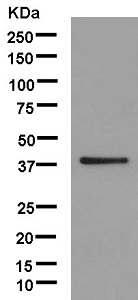Western blot - Anti-SUN3 antibody [EPR12910] - BSA and Azide free (AB250320), expandable thumbnail
