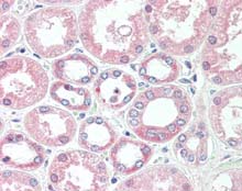 Immunohistochemistry (Formalin/PFA-fixed paraffin-embedded sections) - Anti-Superoxide Dismutase 1 antibody [2F5] (AB115750), expandable thumbnail