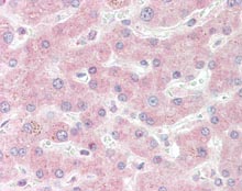 Immunohistochemistry (Formalin/PFA-fixed paraffin-embedded sections) - Anti-Superoxide Dismutase 1 antibody [2F5] (AB115750), expandable thumbnail