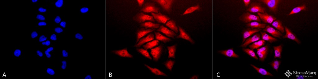 Immunocytochemistry/ Immunofluorescence - Anti-Superoxide Dismutase 1 antibody (AB13499), expandable thumbnail