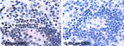 Immunohistochemistry (Formalin/PFA-fixed paraffin-embedded sections) - Anti-Superoxide Dismutase 1 antibody (AB13499)