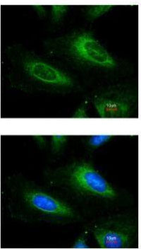 Immunocytochemistry/ Immunofluorescence - Anti-Superoxide Dismutase 1 antibody (AB183881), expandable thumbnail