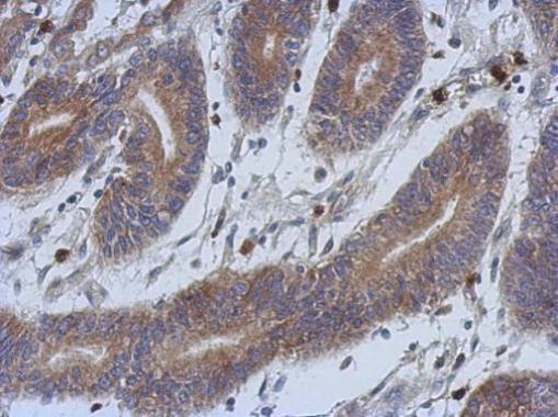 Immunohistochemistry (Formalin/PFA-fixed paraffin-embedded sections) - Anti-Superoxide Dismutase 1 antibody (ab183881), expandable thumbnail