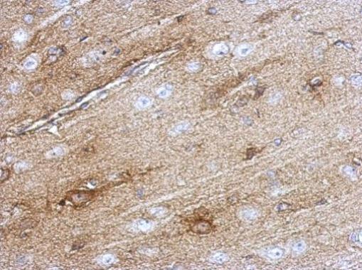 Immunohistochemistry (Formalin/PFA-fixed paraffin-embedded sections) - Anti-Superoxide Dismutase 1 antibody (AB183881), expandable thumbnail