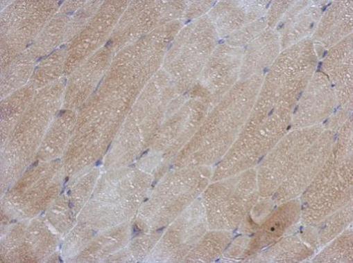 Immunohistochemistry (Formalin/PFA-fixed paraffin-embedded sections) - Anti-Superoxide Dismutase 1 antibody (AB183881), expandable thumbnail