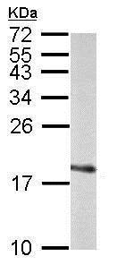 Western blot - Anti-Superoxide Dismutase 1 antibody (AB183881), expandable thumbnail