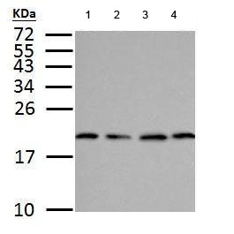 Western blot - Anti-Superoxide Dismutase 1 antibody (AB183881), expandable thumbnail