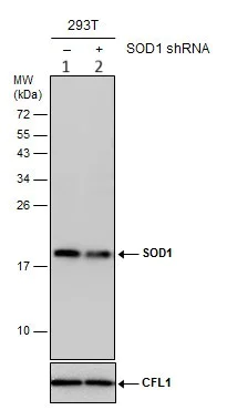 Western blot - Anti-Superoxide Dismutase 1 antibody (AB183881)