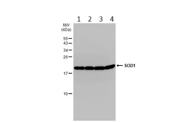 Western blot - Anti-Superoxide Dismutase 1 antibody (AB183881)
