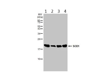 Western blot - Anti-Superoxide Dismutase 1 antibody (AB183881)
