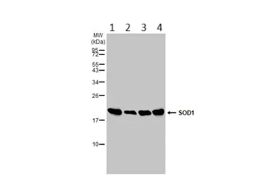 Western blot - Anti-Superoxide Dismutase 1 antibody (AB183881)
