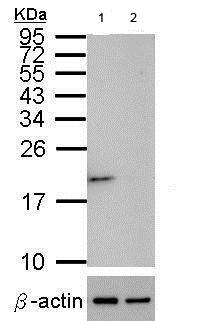 Western blot - Anti-Superoxide Dismutase 1 antibody (ab183881), expandable thumbnail