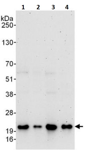 Western blot - Anti-Superoxide Dismutase 1 antibody (AB245352), expandable thumbnail