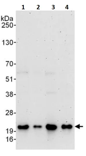 Western blot - Anti-Superoxide Dismutase 1 antibody (AB245352)