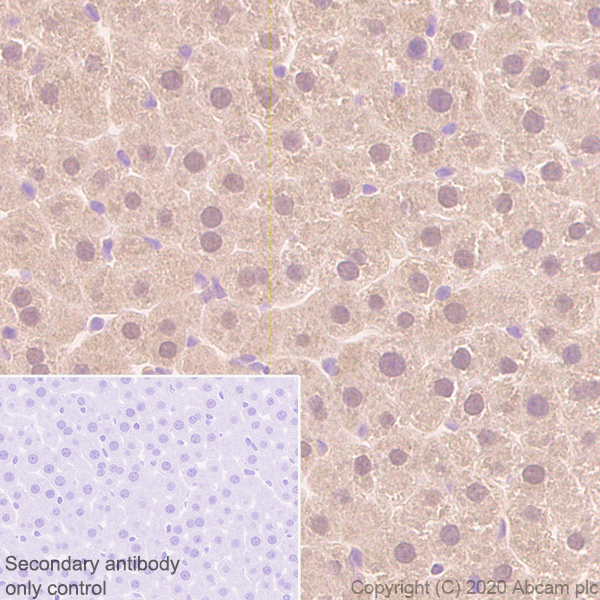 Immunohistochemistry (Formalin/PFA-fixed paraffin-embedded sections) - Anti-Superoxide Dismutase 1 antibody [EP1727Y] (AB51254), expandable thumbnail