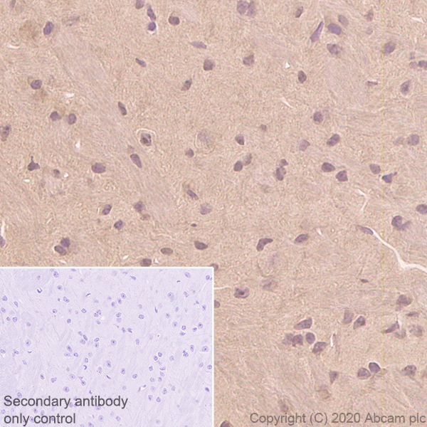 Immunohistochemistry (Formalin/PFA-fixed paraffin-embedded sections) - Anti-Superoxide Dismutase 1 antibody [EP1727Y] (ab51254), expandable thumbnail