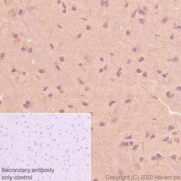 Immunohistochemistry (Formalin/PFA-fixed paraffin-embedded sections) - Anti-Superoxide Dismutase 1 antibody [EP1727Y] (AB51254)
