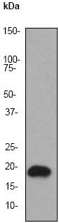 Western blot - Anti-Superoxide Dismutase 1 antibody [EP1727Y] (ab51254), expandable thumbnail