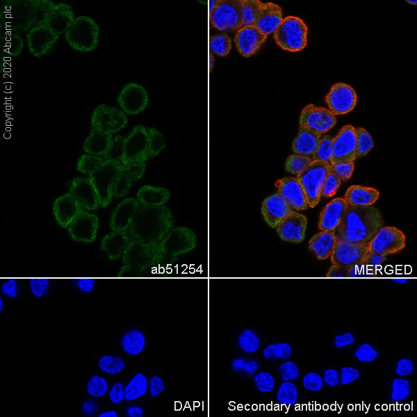 Immunocytochemistry/ Immunofluorescence - Anti-Superoxide Dismutase 1 antibody [EP1727Y] - BSA and Azide free (AB238954)