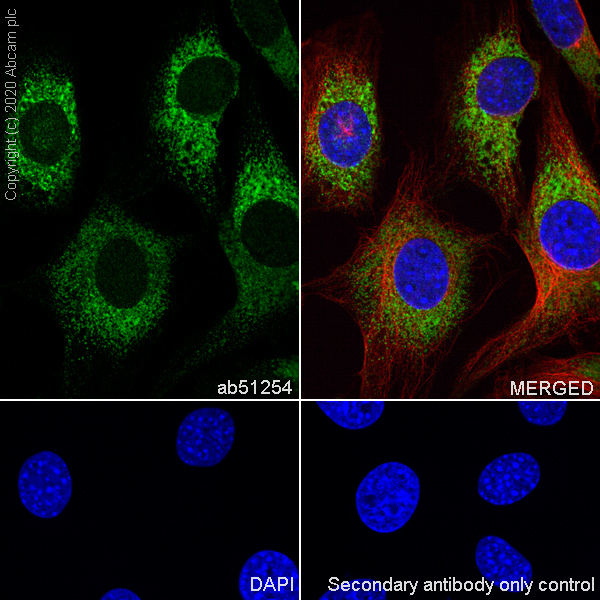 Immunocytochemistry/ Immunofluorescence - Anti-Superoxide Dismutase 1 antibody [EP1727Y] - BSA and Azide free (AB238954), expandable thumbnail