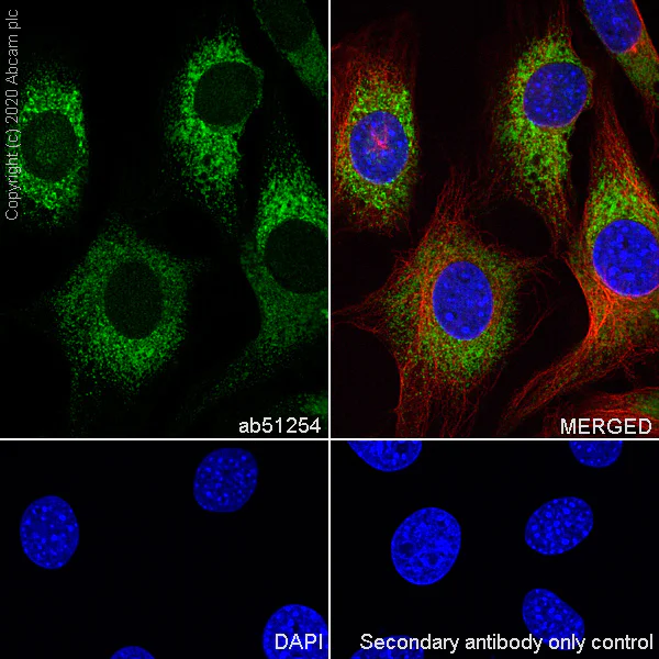 Immunocytochemistry/ Immunofluorescence - Anti-Superoxide Dismutase 1 antibody [EP1727Y] - BSA and Azide free (AB238954)