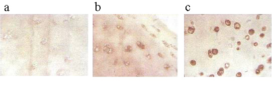 Immunohistochemistry (Formalin/PFA-fixed paraffin-embedded sections) - Anti-Superoxide Dismutase 3/EC-SOD antibody [4G11G6] (AB80946), expandable thumbnail